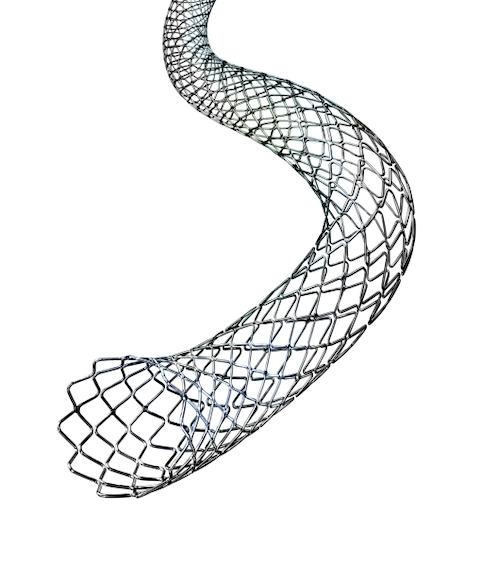 Example Stent 1